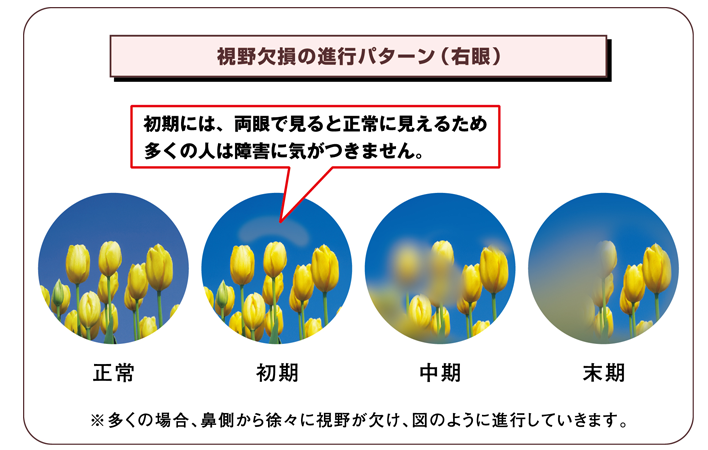01.png 01.png